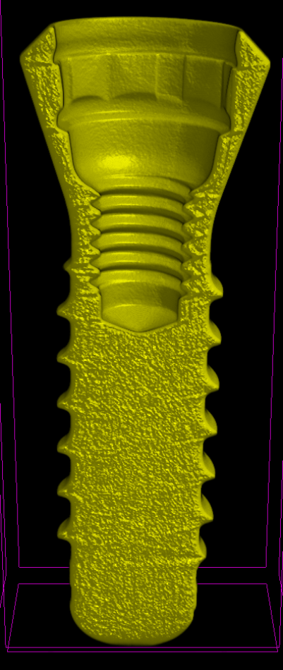 Implants